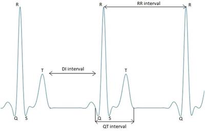 Information Flow Between Heart Rhythm, Repolarization, and the Diastolic Interval Series for Healthy Individuals and LQTS1 Patients